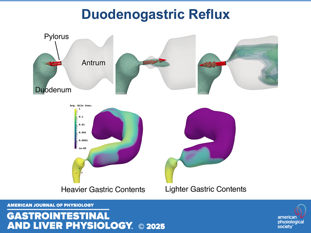 Duodenogastric Reflux in Health and Disease: Insights from a CFD Model