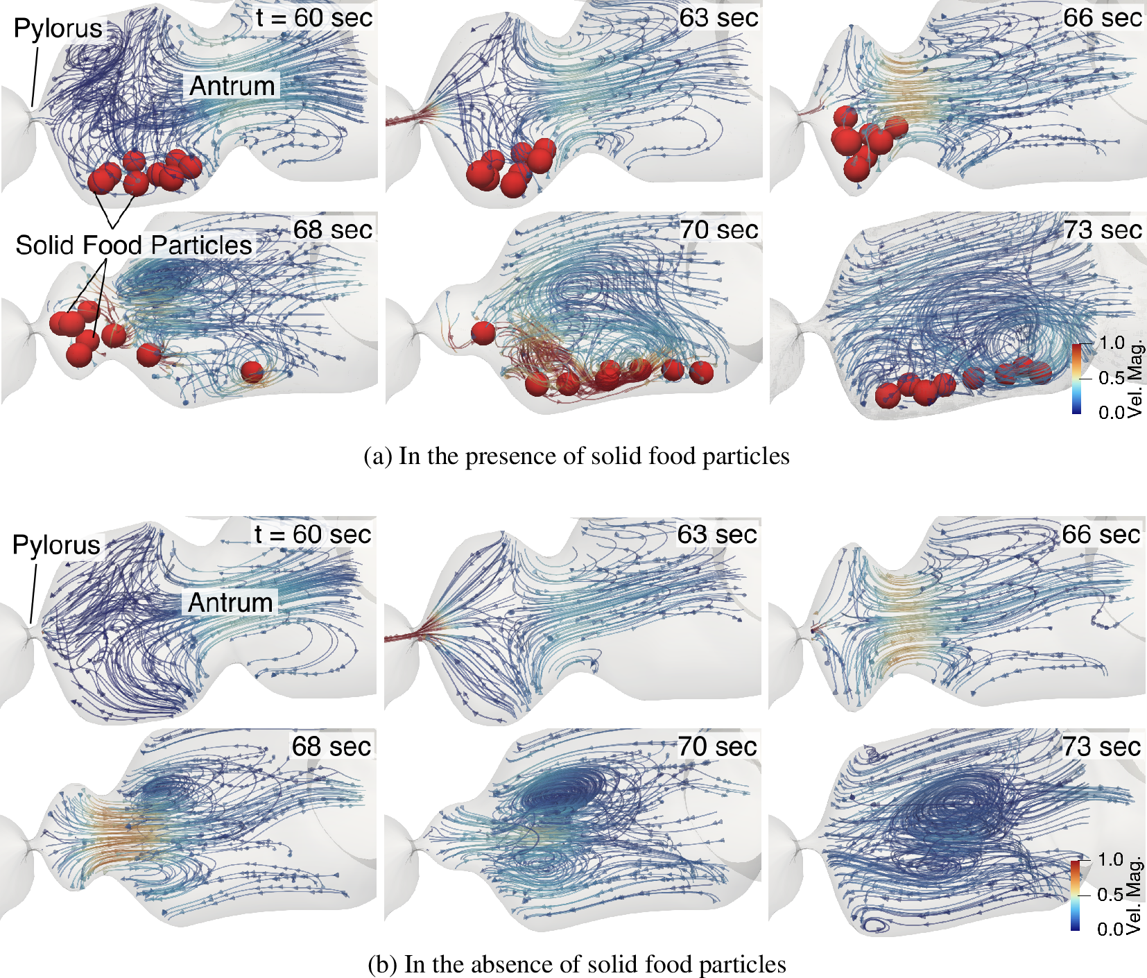 In Silico Study of Solid Food Particles in the Stomach During Gastric Digestion